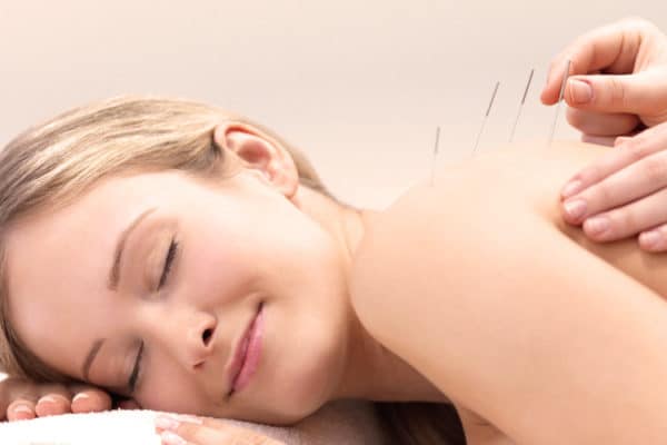 5 Key Secrets to Successful Acupuncture