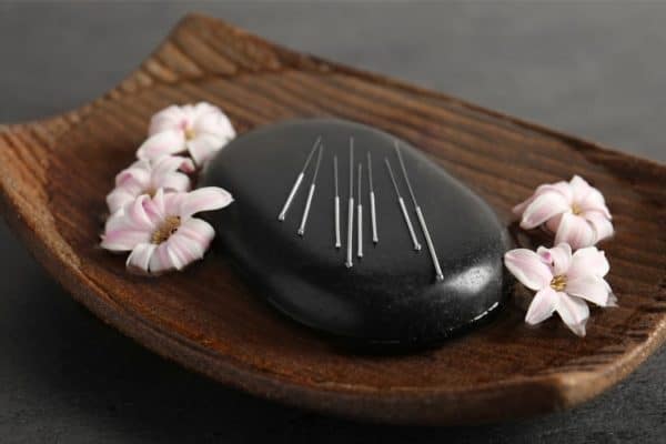 The Definitive Guide to Acupuncture for Infertility