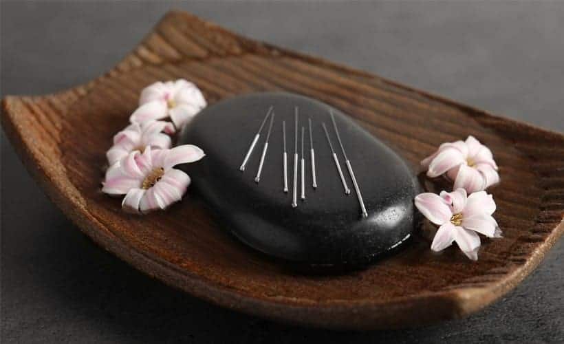 The Definitive Guide to Acupuncture for Infertility