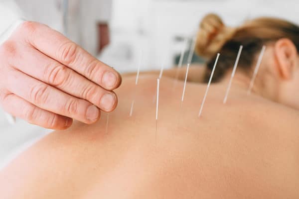 Rest, Relax & Reset - How Acupuncture Can Reset the Nervous System and Improve Fertility Outcomes