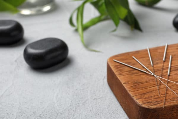 Fertility Acupuncture for IVF and FET