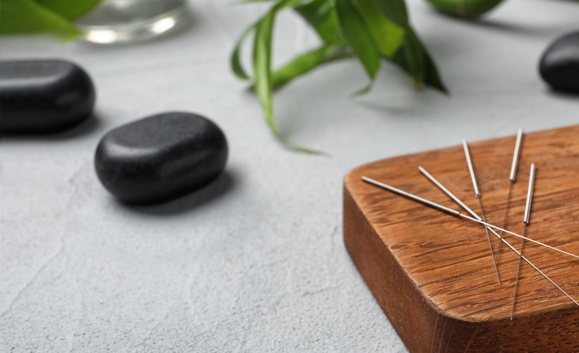 Fertility Acupuncture for IVF and FET